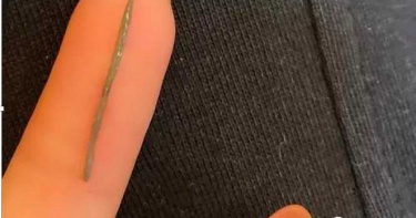 零食吃出鐵釘!女子假牙咬壞了 廠商:事情有待核實