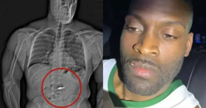 嫌犯將偷來的鑽石吞到肚子裡。（圖／翻攝自X／@unlimited_ls）