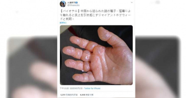 種植不明包裹內種子慘遭灼傷? 原來又是謠言惹禍
