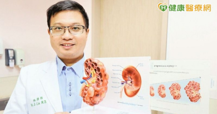 年輕時發現多囊腎　透過治療可延緩洗腎時間