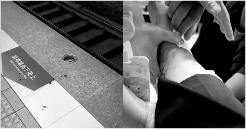 今(24)日，一位女性民眾搭乘火車在台鐵南港站下車時，竟一腳踩進一個已經破裂的月台警示燈蓋（左）中，造成腳部受傷（右）被緊急送醫。（圖／翻攝FB／爆料公社）
