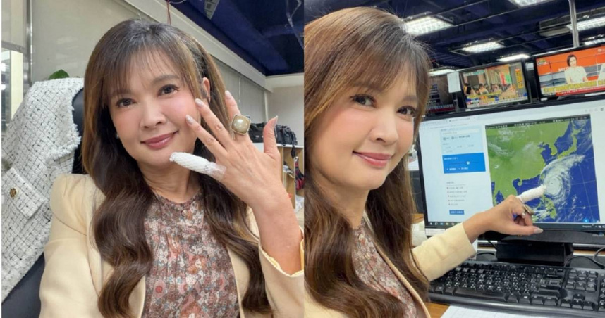 王淑麗播報薔琵颱風「小指頭包紮」超醒目　親揭意外經過
