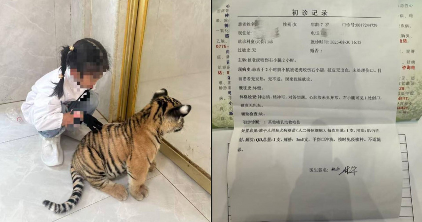 女童參加動物園的小老虎互動過程中，遭到小老虎咬傷。（圖／翻攝自網易新聞）