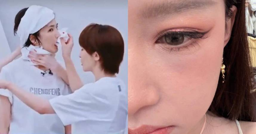 《乘風2026》女星健康狀況不斷。（圖／翻攝自微博）