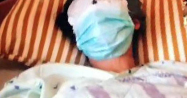 經過鼻梁與雙眼手術後，潘小妹復原狀況良好，已經可以睜眼視人。（圖／翻攝畫面）