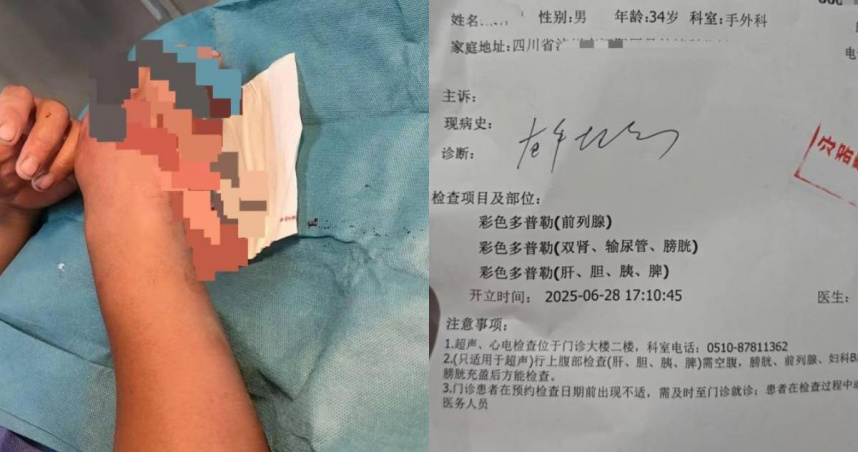 傷者就醫處理手部傷口，卻被告知需要進行包括前列腺在內的多項檢查。（圖／翻攝自齊魯晚報）