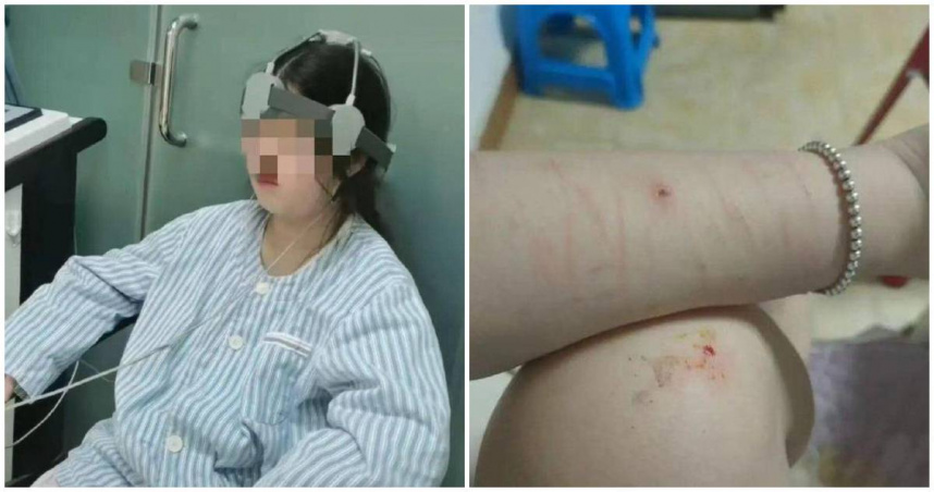 中國河南省一名年僅13歲的少女冉冉（化名），2年前在學校課堂上被同學打鬧時拋出的籃球擊中頭部，最終改變了她的人生。（圖／翻攝九派新聞）