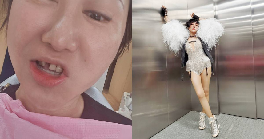 59歲藝人藍心湄26日在自己的Facebook上貼出一張照片，可以看見她的上排牙齒缺一顆門牙。（圖／Facebook／藍心湄 Hsin-Mei Lan）