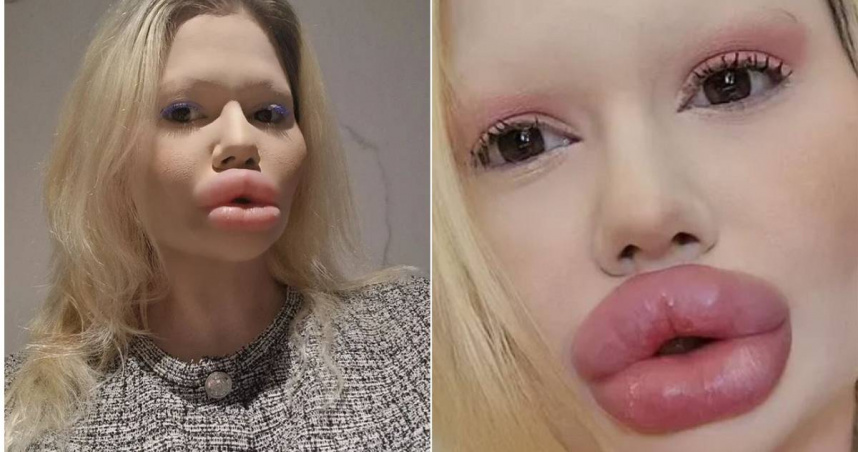 女子表示，她因牙痛就醫卻被牙醫師2度拒診，讓她不滿。（圖／翻攝自IG／andrea88476）