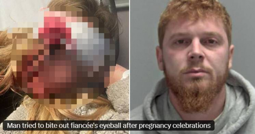 英國男子班傑明瓊斯因施暴未婚妻、試圖咬出其眼球而再度入獄。（圖／翻攝自X）