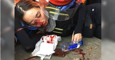 女遭射擊摘除眼球 港民號召百萬人要「警察還眼」