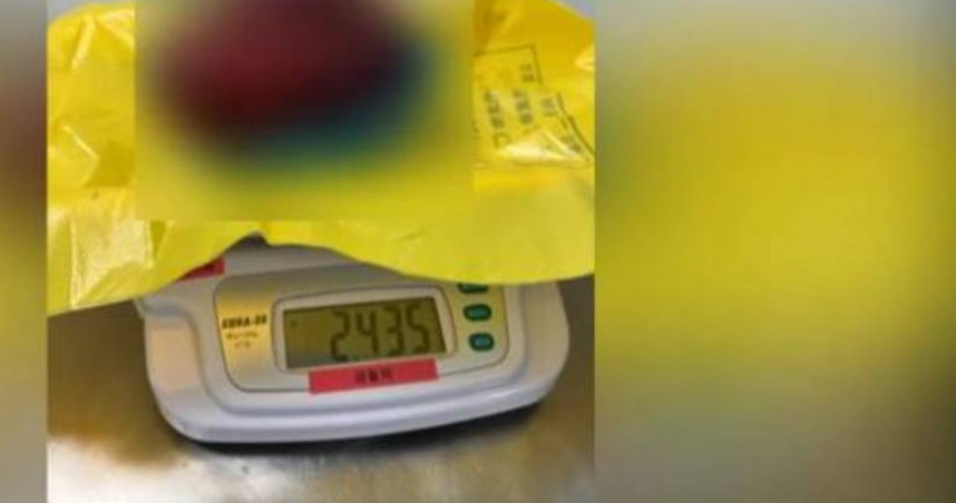 婷婷的肚子裡長了一顆巨大的腫瘤，直徑長達27公分。（圖／翻攝自微博）