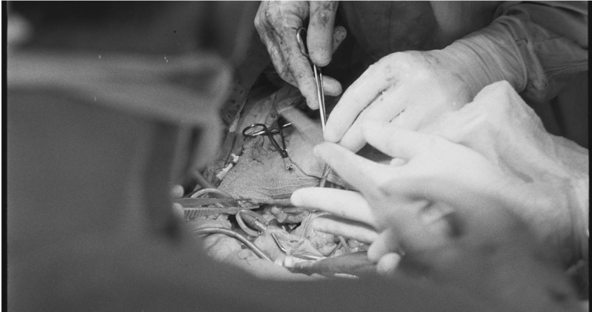 專科醫師黃軒提醒，陰莖增大術併發症多，術後滿意度未必理想。（示意圖／達志／美聯社）