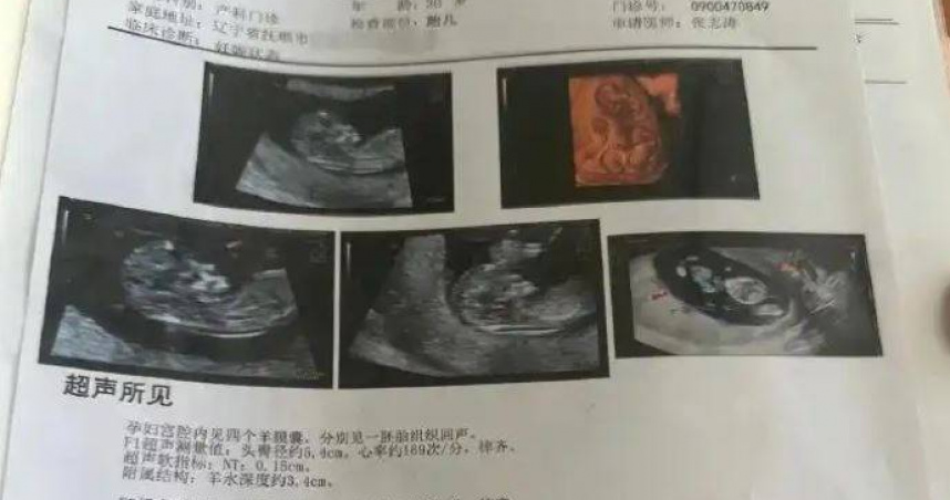 大陸遼寧省撫順市1名孕婦產檢經歷近日引發關注。（圖／翻攝自極目新聞）