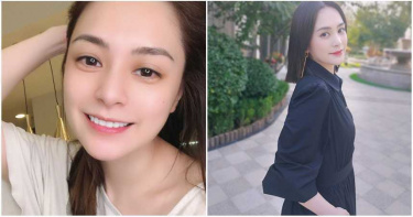 阿嬌眉骨撞破!「3吋蜈蚣傷痕照」曝光 感嘆:遮瑕膏是偉大發明