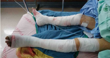 雲林連續傳出狗群圍攻老人 9旬嬤田中小腿、腳掌遭咬見骨