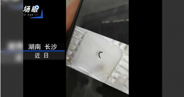 姐弟倆尿液中驚現黑色幼蟲 醫追病史才知竟是溪水惹禍