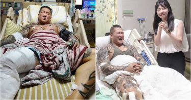 館長暗夜獨垂淚…悲泣曝「大腿破爛廢掉了」 釣出高嘉瑜暖心「這樣回」