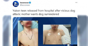 15歲少年逛街遇惡犬…英勇護友「半張臉遭咬傷」 母傷心:兒子的臉恐失知覺