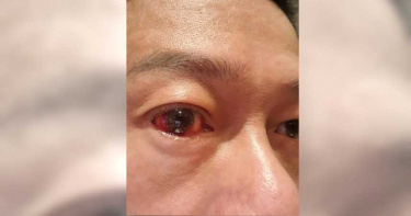 李康生外地拍戲眼睛中邪 無法宣傳《粽邪2》找好兄弟喝酒去