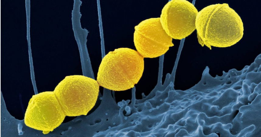 有醫師示警，近期臨床觀察到A型鏈球菌感染個案明顯增加，若家長觀察到小朋友活動力下降、血壓變化，就應趕緊就醫。（圖／翻攝unsplash）