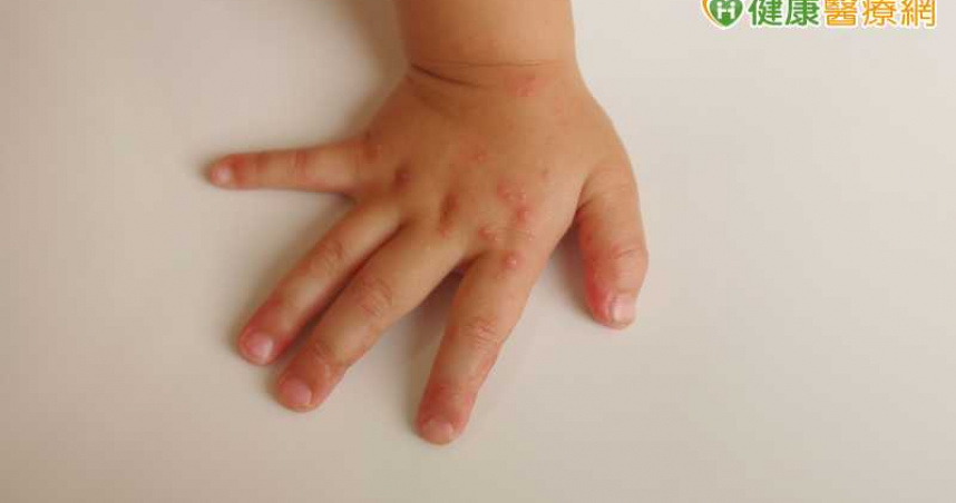 近4周社區以克沙奇A6型為多　門急診人次較春節期間上升