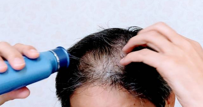 台大團隊研發「20天生髮精華」登國際。（示意圖／翻攝自photo AC）