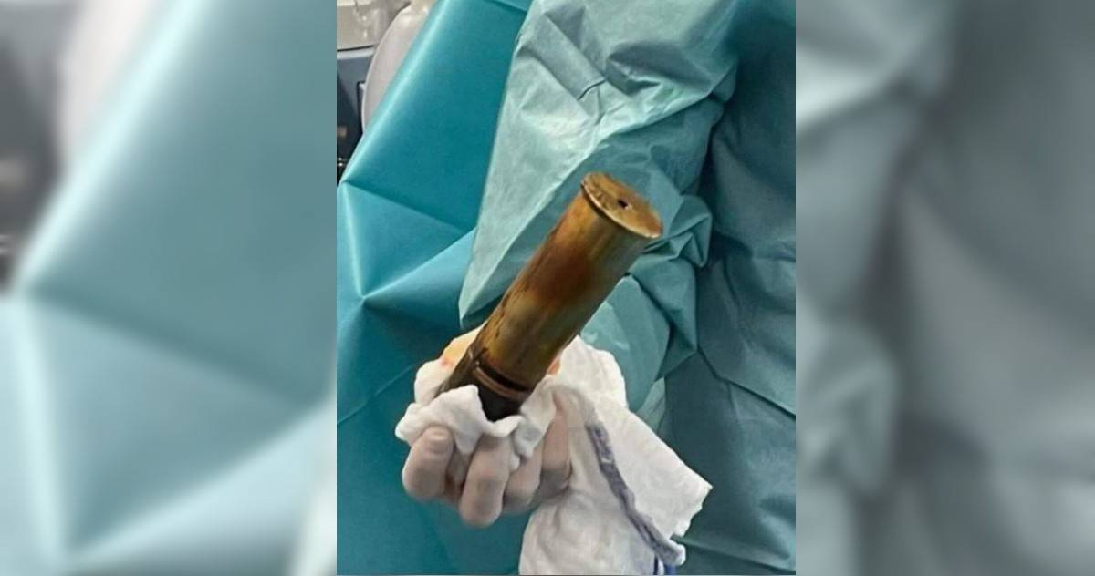 Re: [閒聊] 小知識：肛門只能張開4公分