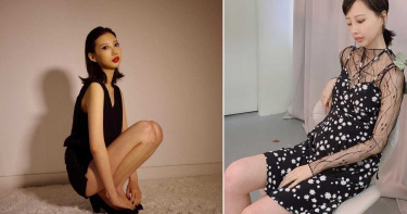 女星罹患罕見腺樣囊性癌!抗癌9年發文曝近況 粉絲正能量打氣