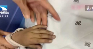 5歲女童吃「自家醃製泡菜」指甲嘴唇發紫!醫一看曝「驚人真相」