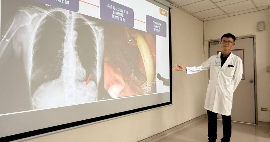 臺中醫院肝膽腸胃科醫師吳明駿利用無痛胃鏡與異物夾，成功解開胃內揪結的鼻胃管並順利拔出。（圖／衛生福利部臺中醫院提供）