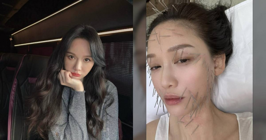 陳喬恩為了愛美，忍痛做針雕保養。（圖／陳喬恩IG）