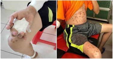 兒被逼吃屎!全身射滿「蜂窩彈孔」3指截肢 單親媽痛哭:拜託保護我們