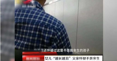 「女兒越來越醜」夫疑戴綠帽氣炸 DNA鑑定出爐竟是因「這個病」長歪