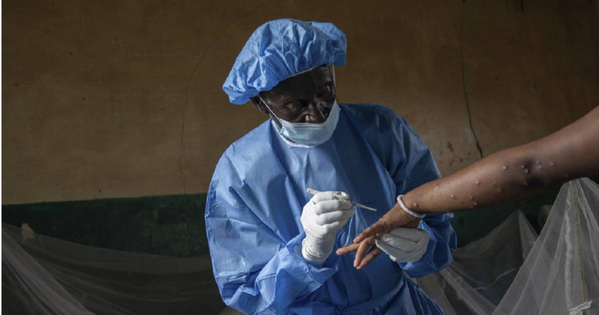 今年以來，非洲中部國家「剛果民主共和國」爆發不明疾病，至今已有431人患病，其中53人死亡。（示意圖／達志／美聯社）