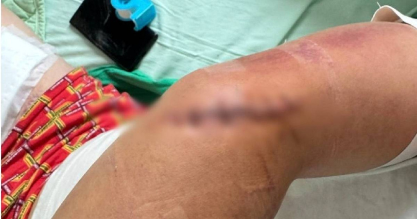 台南仁德服務區有1名男子遭陌生人持刀砍傷，造成四肢多處嚴重撕裂傷。（圖／翻攝爆料公社）