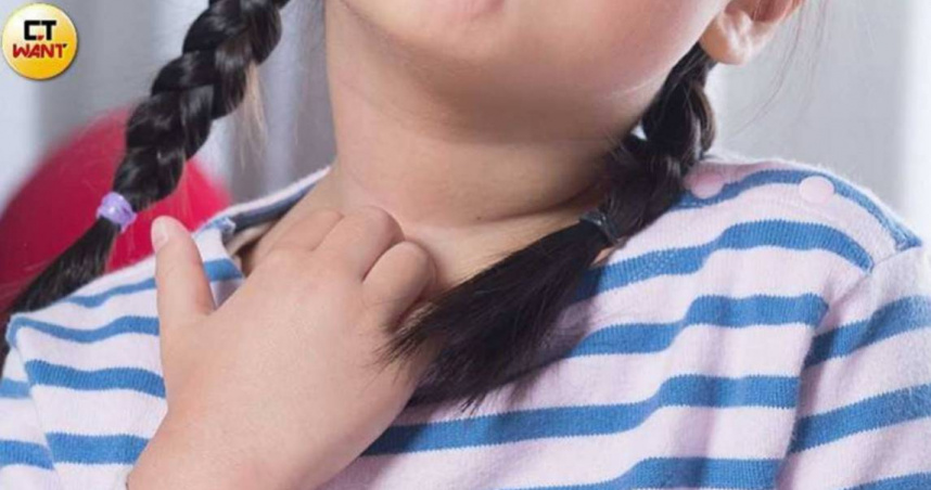 台灣約有30多萬名患者深受異位性皮膚炎之苦，據統計，重度異膚患者年平均回診次數超過30次。（圖／張雅淳攝）