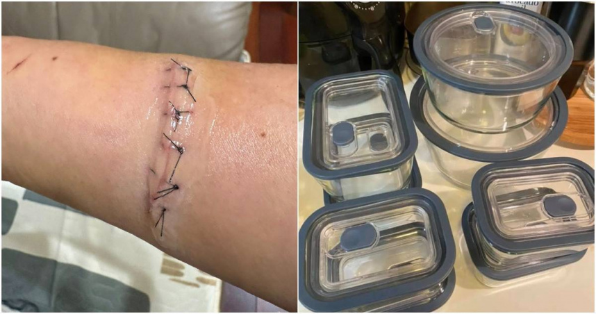 一名網友控訴，他在全聯換購的保鮮碗竟直接爆裂，導致手臂肌腱遭割斷，縫了好幾針。（圖／擷取自Facebook／全聯消費經驗老實說）