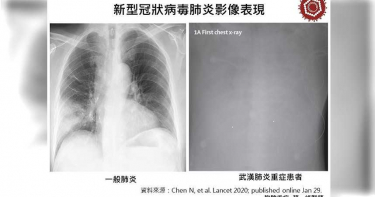 武漢肺炎/中國死亡人數持續增加 暗黑秘密可能是這個
