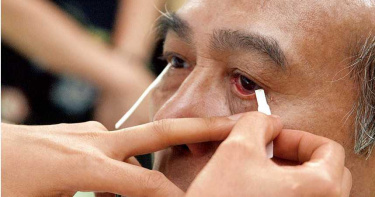 眼睛絕症1/名醫罹病竟不知 「眼皮下垂」差點砸了自己招牌