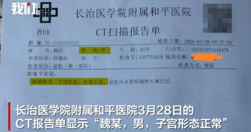 山西一名男性患者電腦斷層（CT）報告出現「子宮形態正常」字樣，引發關注。（圖／翻攝自江蘇新聞）