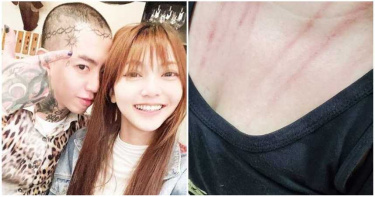 Keanna、莉婭法院外爆衝突!車門夾腳激烈拉扯 「胸口血爪痕」超驚悚