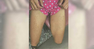 兄弟狠虐10歲女童 拿香燙手腳成蜂窩還摸下體猥褻