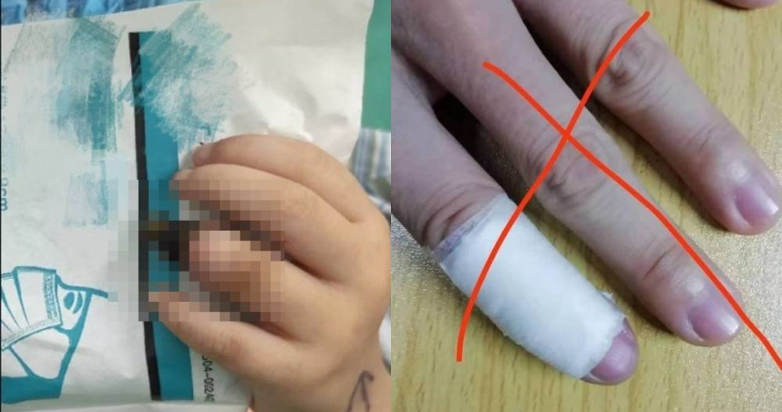 有大陸微博主「Do醫生」分享手指受傷包紮的注意事項，示警錯誤包紮恐怕會害手指壞死。（圖／翻攝自微博／Do醫生）