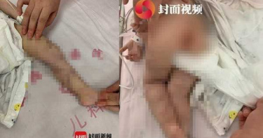 受不了哭鬧!18歲小媽媽瘋狂毆打…1歲兒「高燒抽搐」昏迷6天未醒