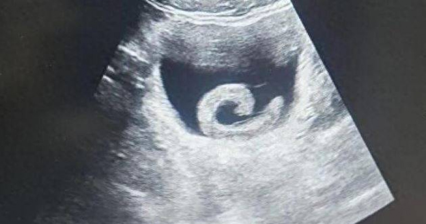 大陸河南省鄭州市近日發生一起離譜卻值得警惕的醫療事件。（圖／翻攝自微博）