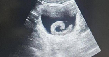 大陸河南省鄭州市近日發生一起離譜卻值得警惕的醫療事件。（圖／翻攝自微博）