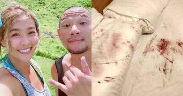 小嫻揭民宿奧客行徑!使用過「衛生棉」黏牆上…床單染一片血紅