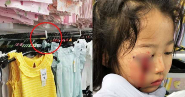 6歲女童遭金屬掛勾「插爆眼睛」 一塊肉掉下來…鮮血狂流