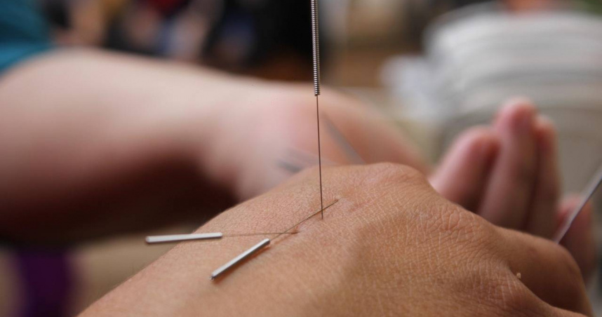 涉案中醫稱使用縫衣針驅鬼，行為超越正常中醫診療範疇。（示意圖／Pixabay）